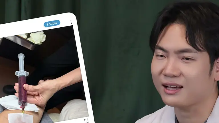 스킨바이브, 볼 꺼짐을 채우는 필러와 무엇이 다른가요?