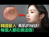 연예인들이 찾는 레이저 시술, 어려 보이는 피부의 조건