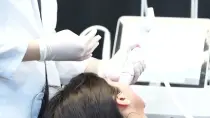 주근깨 레이저 횟수, 기미 동반 여부부터 확인하세요