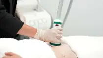심박조율기가 있으면 써마지를 받을 수 있나요?