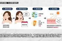 리프팅 효과가 나만 빨리 사라지는 이유, 장비보다 중요한 5가지