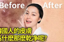 한국인 피부가 좋아 보이는 이유, 병원형 관리 문화의 차이