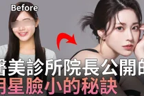 InMode为什么会淤青？FX、Forma与Potenza DDR差异