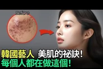艺人常做的激光项目，年轻感皮肤要看哪些条件