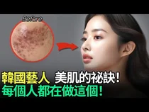 연예인들이 찾는 레이저 시술, 어려 보이는 피부의 조건