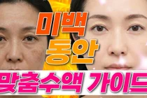 美肌点滴、流行より体の状態を優先すべき理由