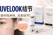 Juvelook 注射后肿块，是结节吗？判断方法与处理方式