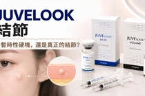 喬雅露結節是什麼？Juvelook 施打後硬塊的判斷方式與處理方法