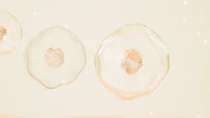 외국인 관광객, 한국 시술 안전한가요? 확인해야 할 5가지