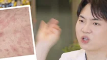 강남역 가까운 피부과, 지하철보다 먼저 확인할 기준